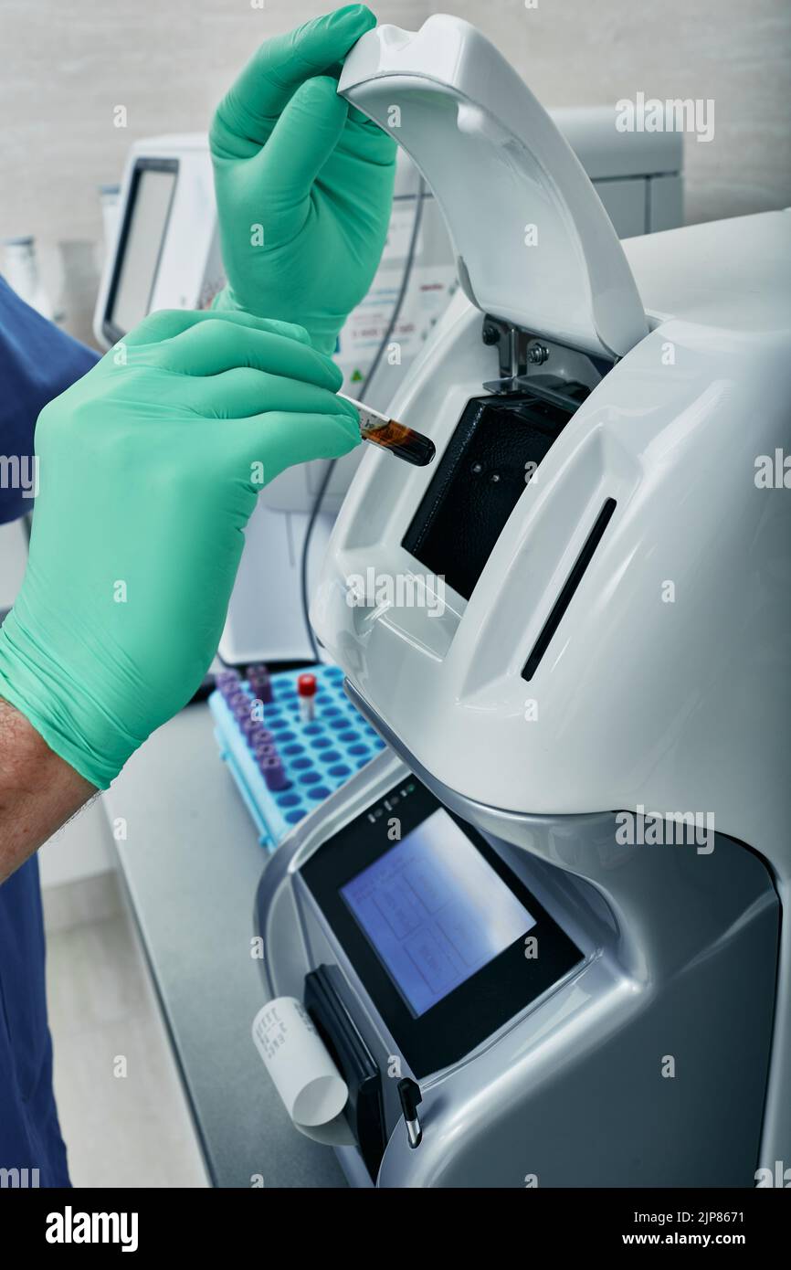 Test der Sedimentationsrate der Erythrozyten. Labortechniker, der Blutprobe in den ESR-Analysator einlädt, Nahaufnahme Stockfoto
