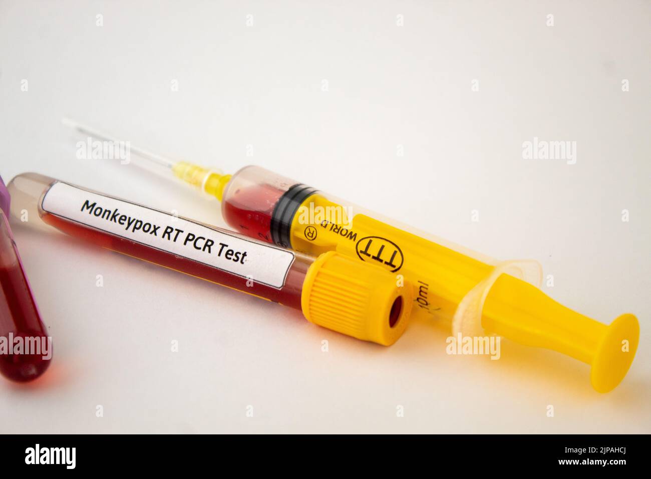 Bluttests auf Monkeypox-Virus, gelbe Spritze und Blutteströhre, isolierter weißer Hintergrund Stockfoto