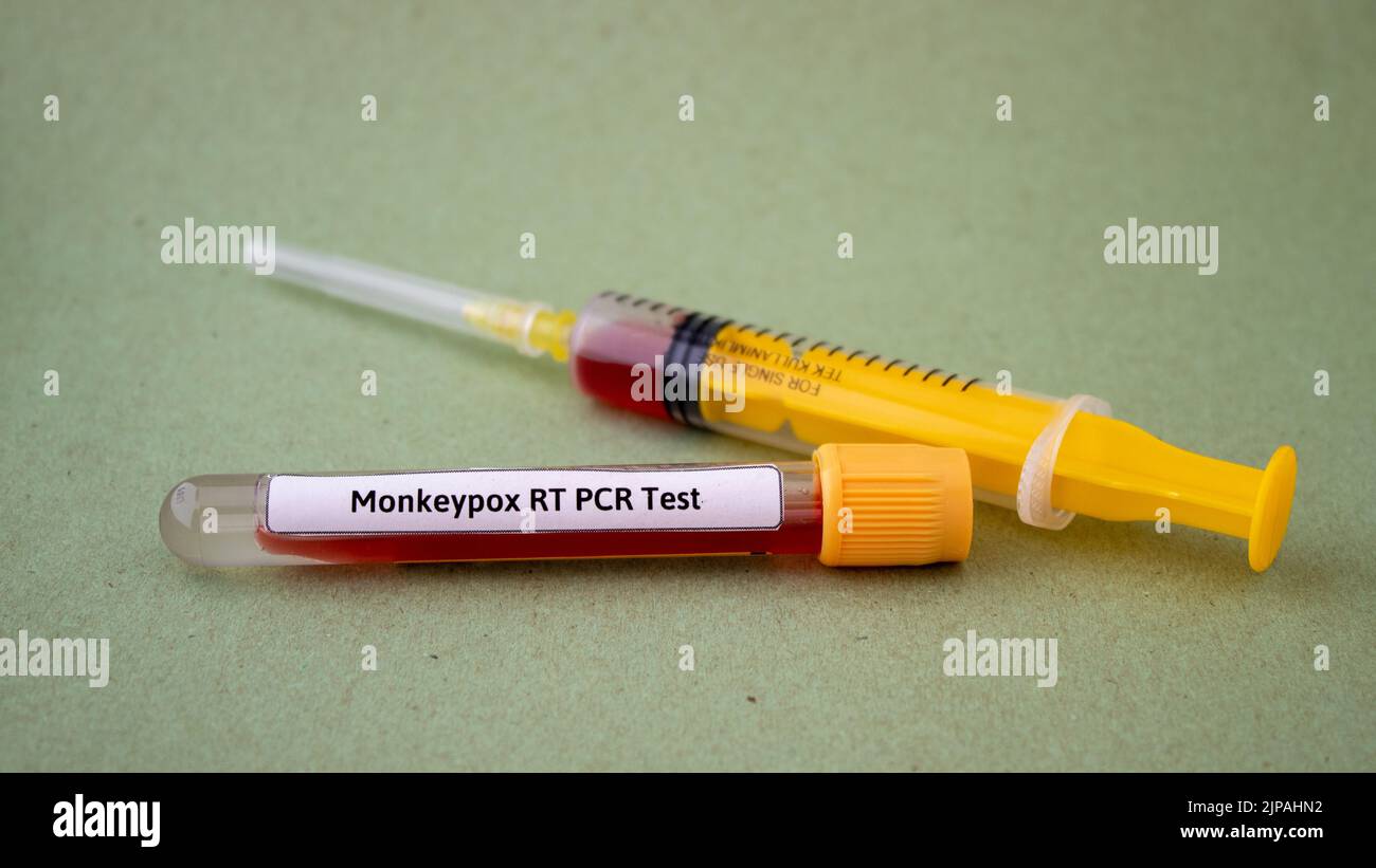 Bluttests auf Monkeypox-Virus, gelbe Spritze und Blutteströhre, isolierter grüner Hintergrund Stockfoto