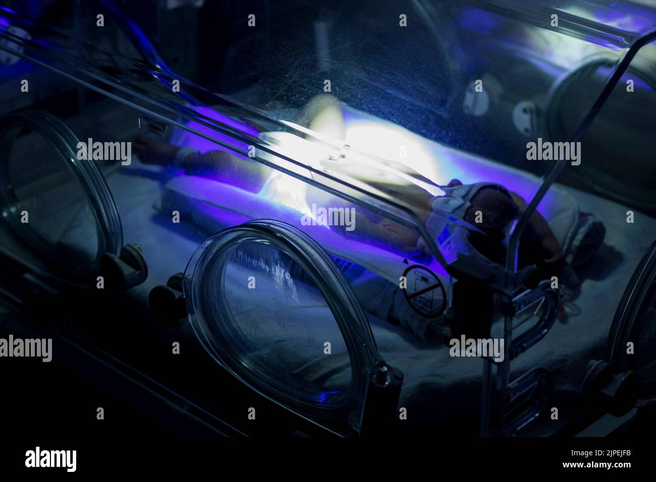 Phototherapie bei Gelbsucht Neugeborenen. Behandlung bei hohem Bilirubin. Stockfoto