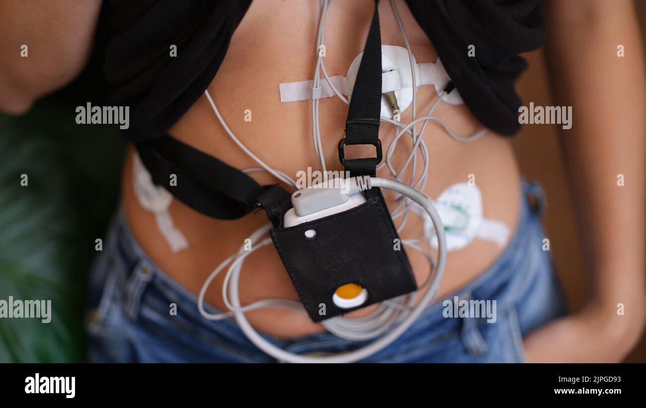 Frau trägt Gerät, Gerät für die tägliche EKG-Überwachung Stockfoto