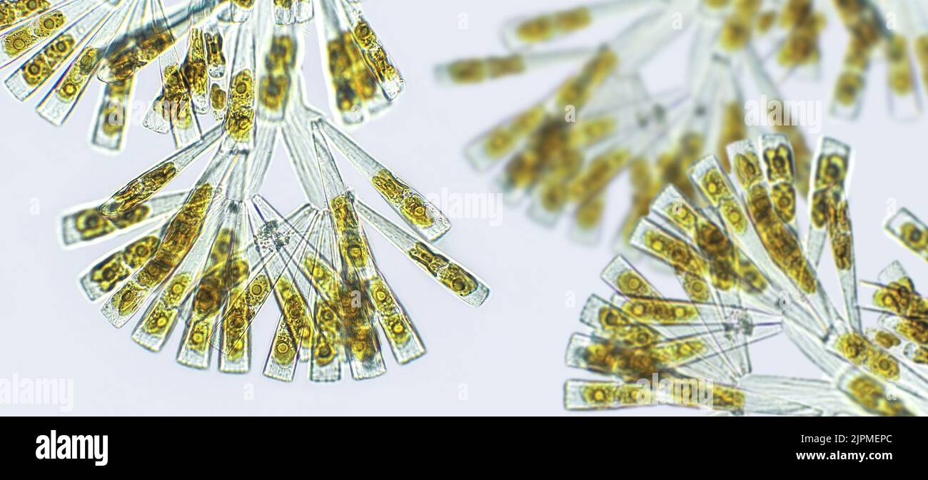 Licmophora sp. Algen, Meeres und SüßwasserKieselalgen unter