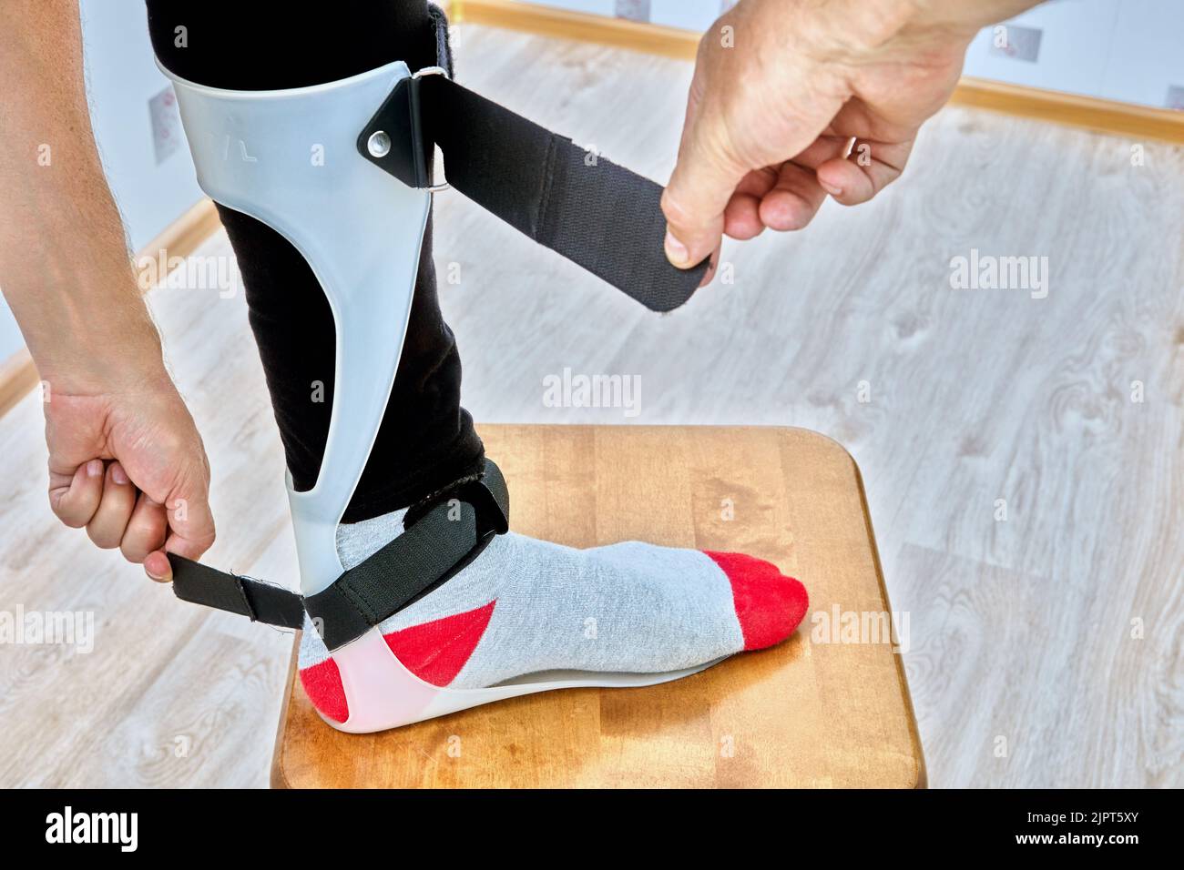 Die orthosis des Fußknöchels wird mit Klettbändern am Bein fixiert. Stockfoto