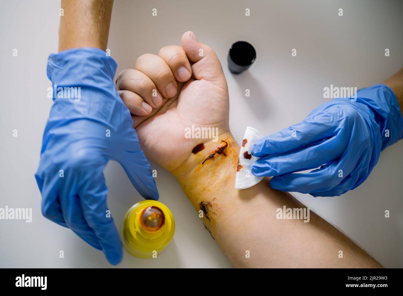 Crop Arzt Anwendung antiseptisch auf verwundete Handgelenk Stockfoto
