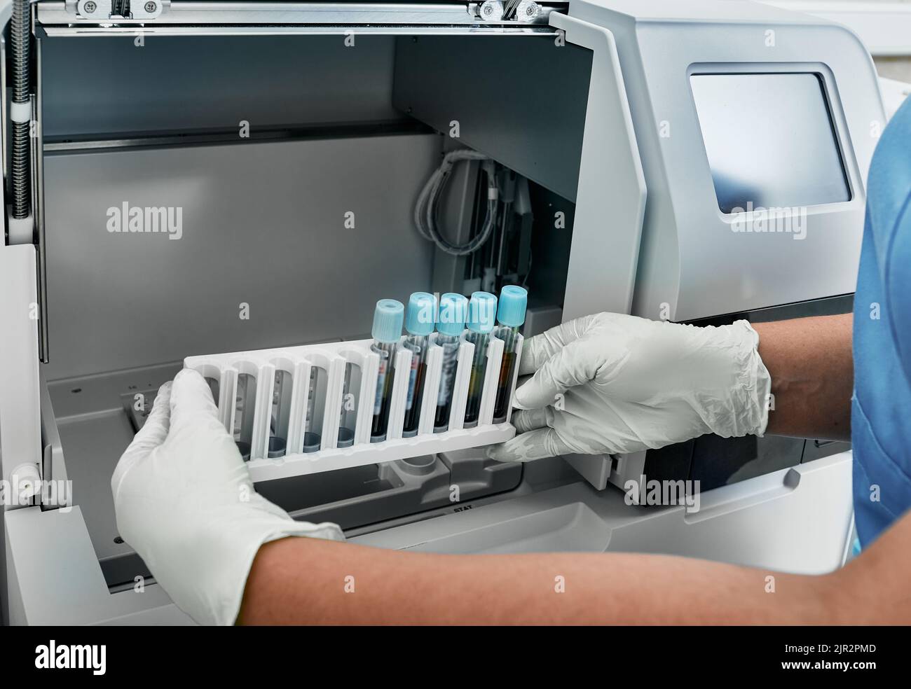 Labortechniker laden Blutproben für die Gerinnungstestanalyse in einem automatischen Gerinnungstestanalysator, Nahaufnahme. Blutproben-Gerinnungsanalyse Stockfoto
