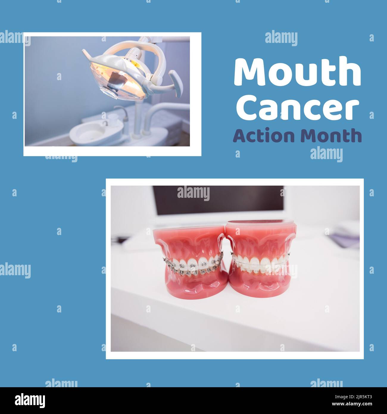 Beleuchtungsgeräte, Zahnersatz in der Zahnarztpraxis mit Mundkrebs Aktion Monat Text, Copy space Stockfoto