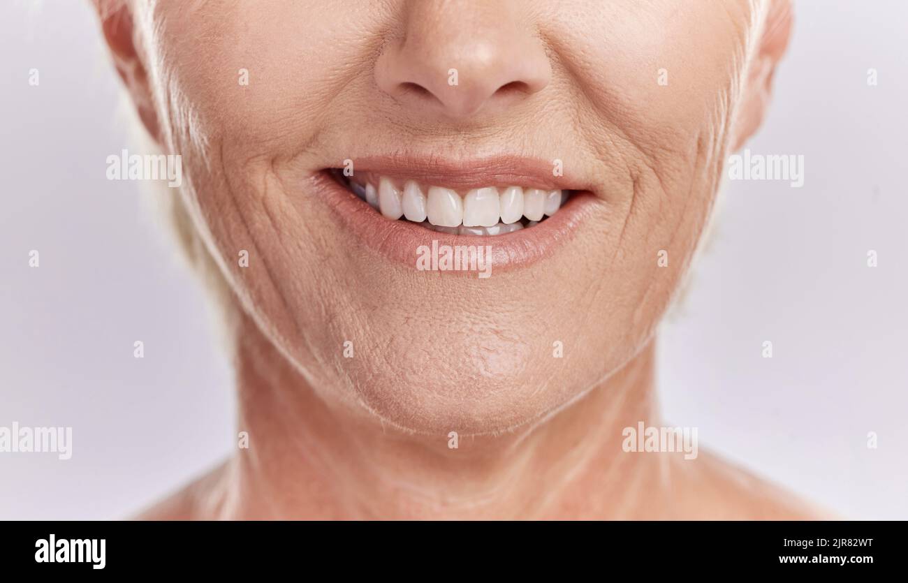 Glückliche Frau mit Zähnen und Lächeln, die ihre natürlich aussehenden Veneers vor einem lila Mockup Studio Hintergrund posiert. Model Frau glücklich mit Stockfoto