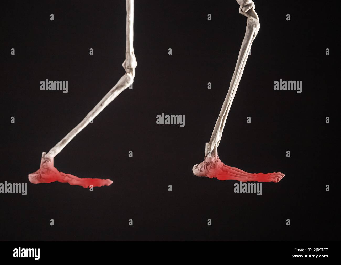 Menschliche Skelettbeine mit schmerzhaften Füßen mit rotem Punkt auf schwarzem Hintergrund. Profilansicht. Verletzung, Übernutzung, Knochenentzündung. Bunions, Metatarsalgie, Fraktur, Sehnenentzündung. Hochwertige Fotos Stockfoto