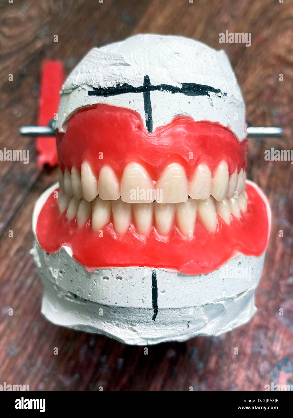 Komplett abnehmbare Zahnprothesen auf Gipsmodellen. Natürliche Vollprothese aus hochwertigen Materialien in Gipsmodell. Selektiver Fokus, Nahaufnahme Stockfoto