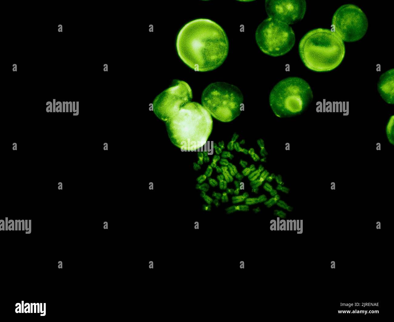 Chromosomen unter Fluoreszenzmikroskop, grün gefärbte menschliche Chromosomen aus Blut Stockfoto