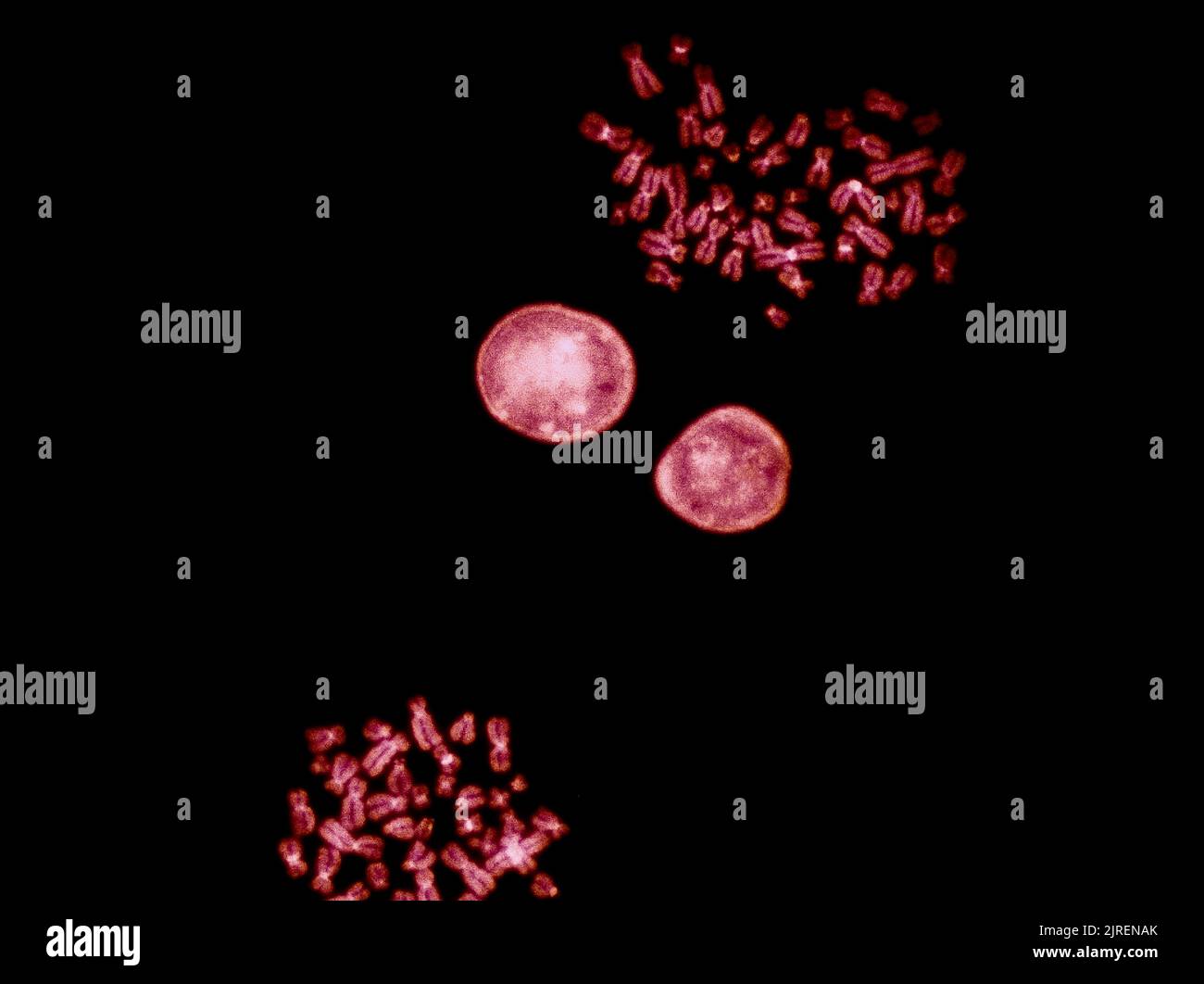 Chromosomen unter Fluoreszenzmikroskop, rot gefärbte menschliche Chromosomen aus Blut Stockfoto