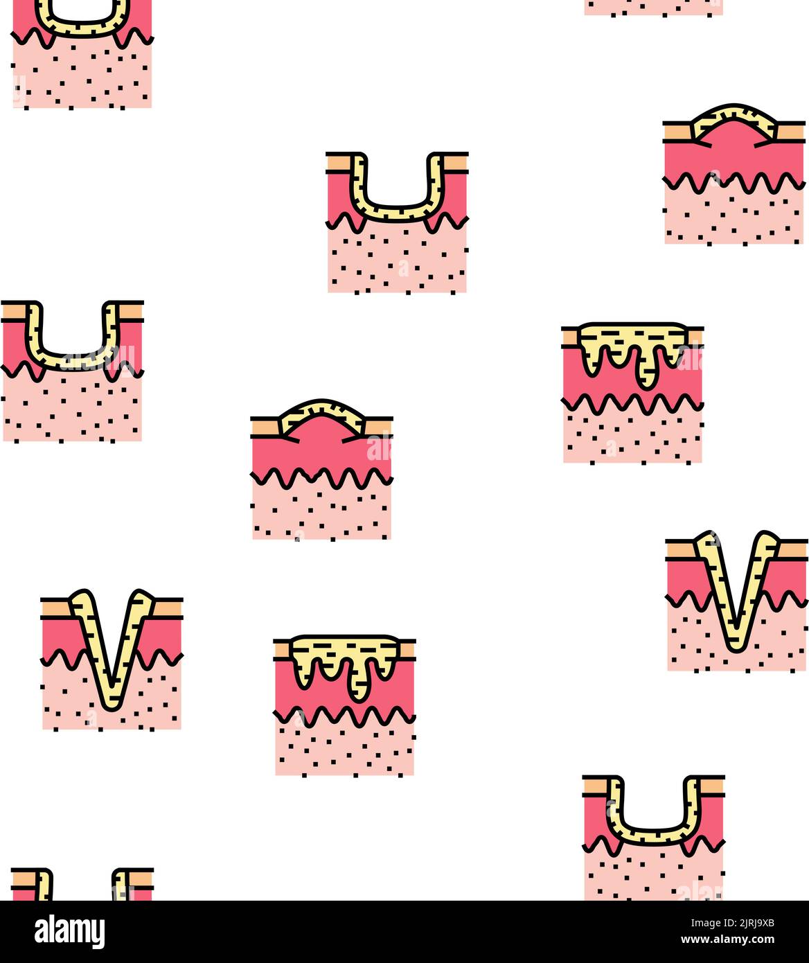 Narbe nach Trauma oder Chirurgie Vektor nahtloses Muster Stock Vektor