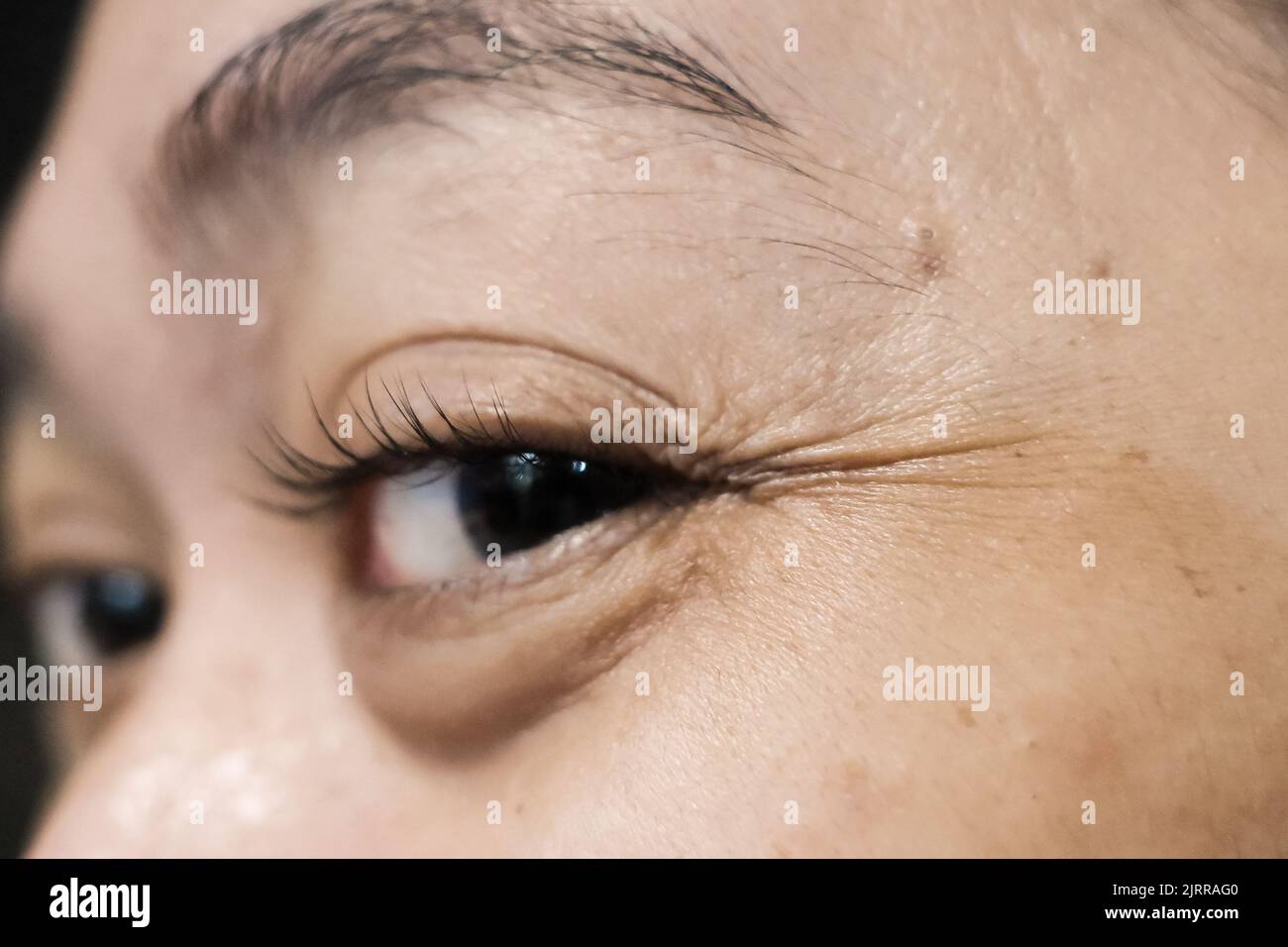 Nahgesicht einer Frau mit faltigen Augenlidern und Augenbeuteln aufgrund von Alterung und Ruhemangel Stockfoto