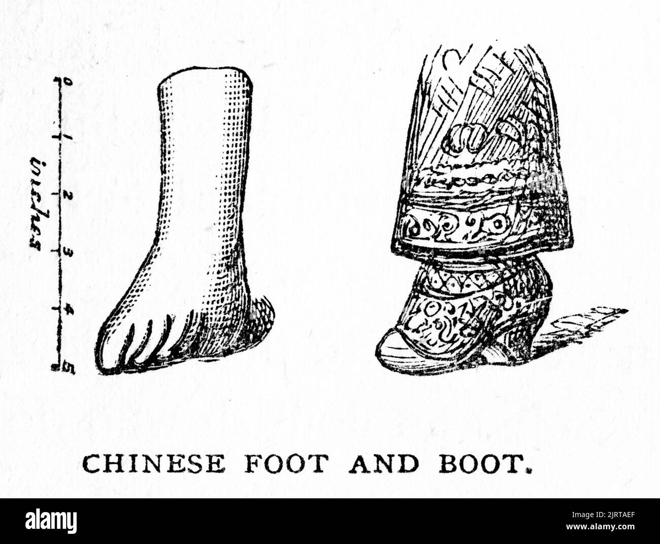 Stich der gebundenen Füße chinesischer Frauen, von A Voyage in the Sunbeam von Baroness Anna 'Annie' Brassey (1839 – 1887), veröffentlicht 1878 Stockfoto