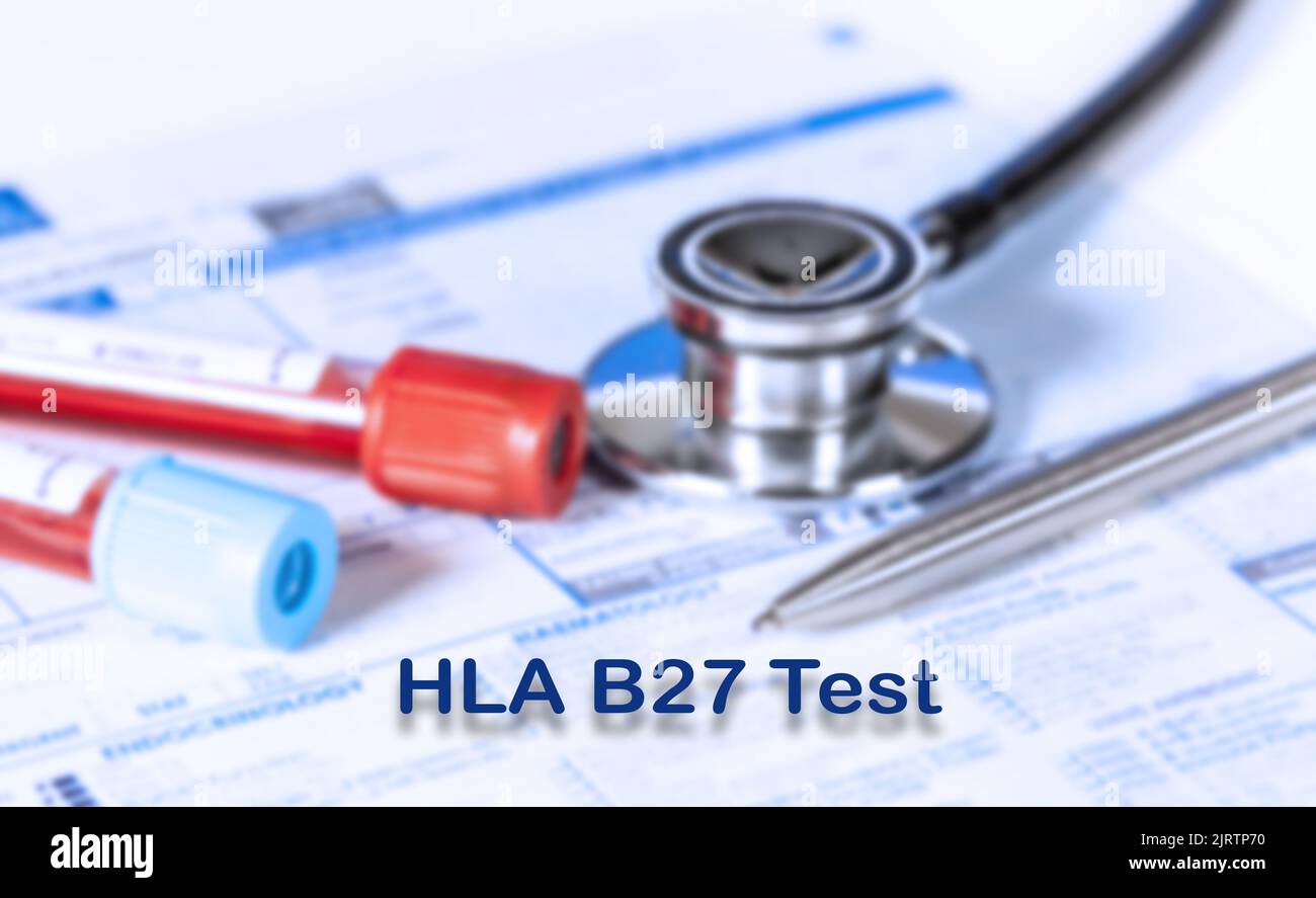HLA B27 Test Testing Medical Concept. Checkup Liste medizinischer Tests mit Text und Stethoskop Stockfoto