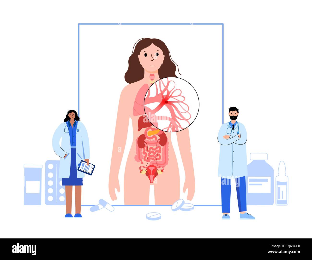 Behandlung der Lungenembolie, Illustration Stockfoto