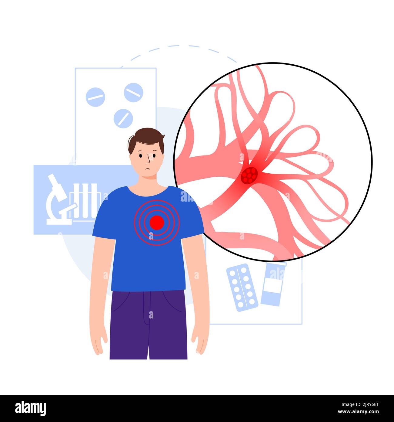 Behandlung der Lungenembolie, Illustration Stockfoto