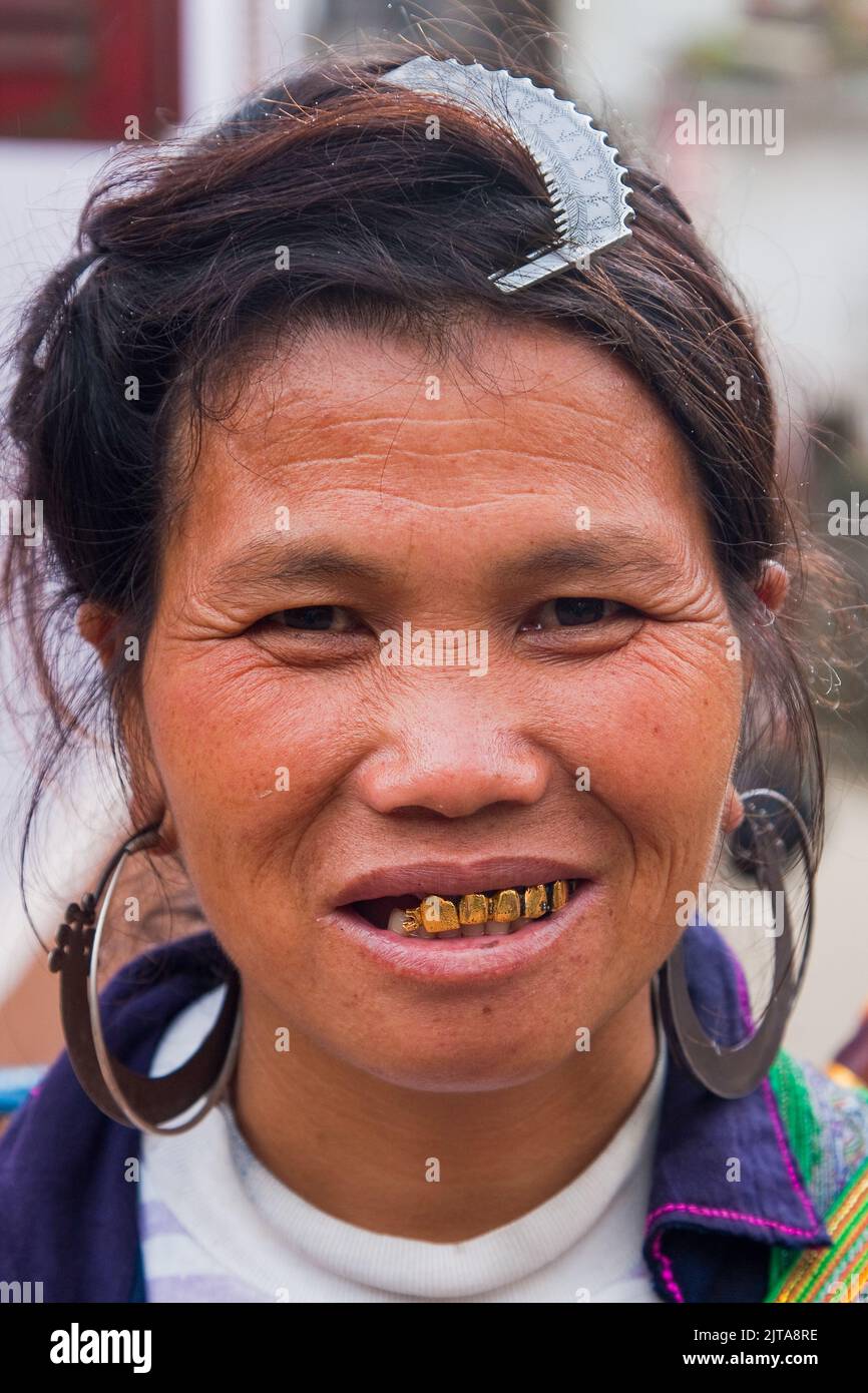 Vietnam, Black Hmong Stammesfrau in Sapa zeigt ihre Zähne, die mit einem Blatt Gold bedeckt sind.Sapa ist eine Stadt in der Nähe der chinesischen Grenze und beliebt bei Stockfoto