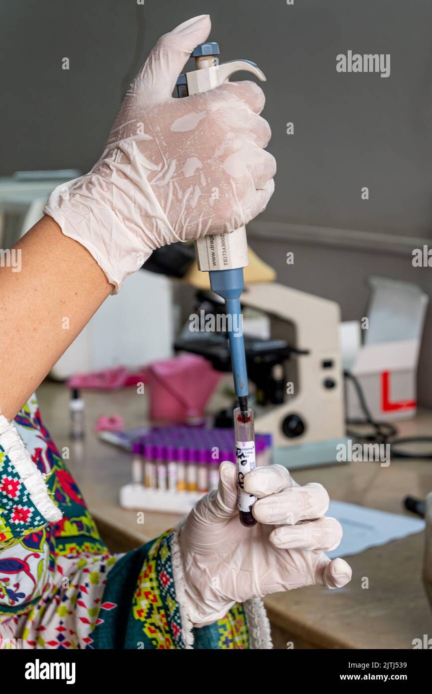Blutprobe im Reagenzglas. Medizinisches Konzept. Medizinische Blutuntersuchungen im Labor Stockfoto