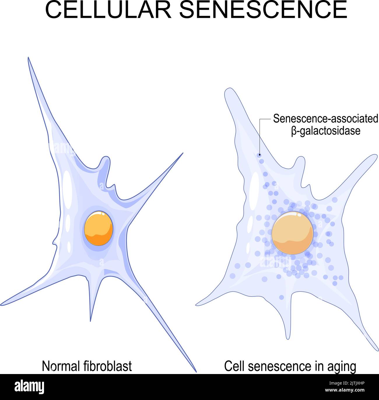 Zelluläre Seneszenz. Verändert die seneszenten Zellen während des Alterns. Vergleich und Unterschied zwischen normaler Fibroblast und Zellseneszenz im Alter. Vektor Stock Vektor