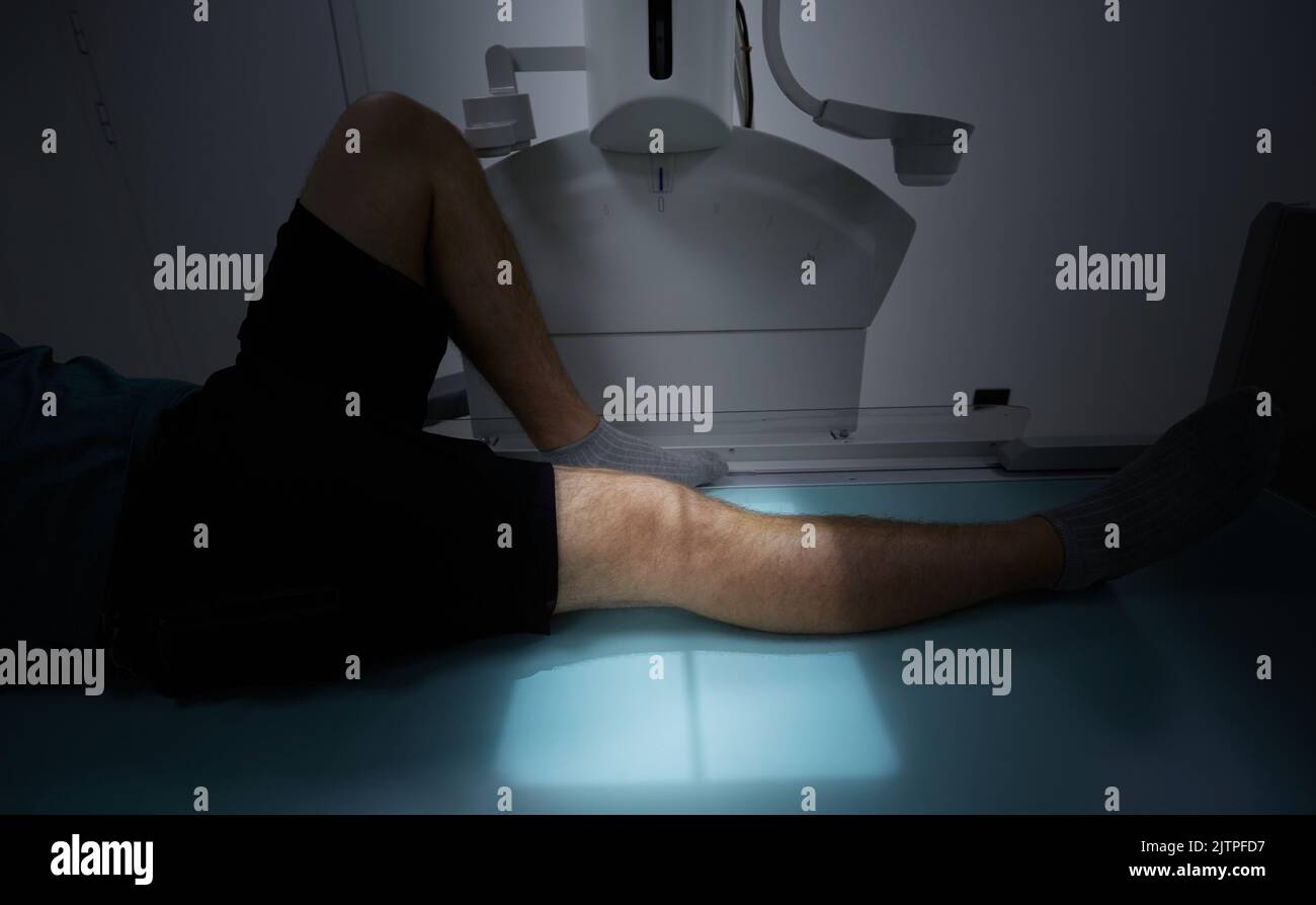 Röntgenaufnahme des Kniegelenkes des Patienten, Nahaufnahme. Röntgenverfahren nach Knie- oder Knochenbruch Stockfoto