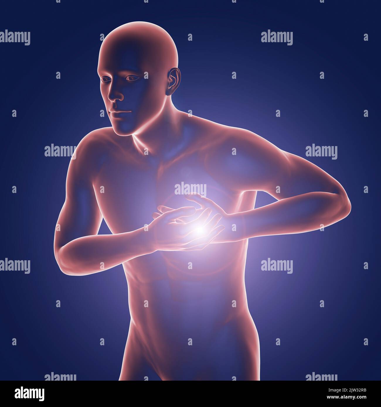 Mann mit Brustschmerzen, Illustration. Stockfoto