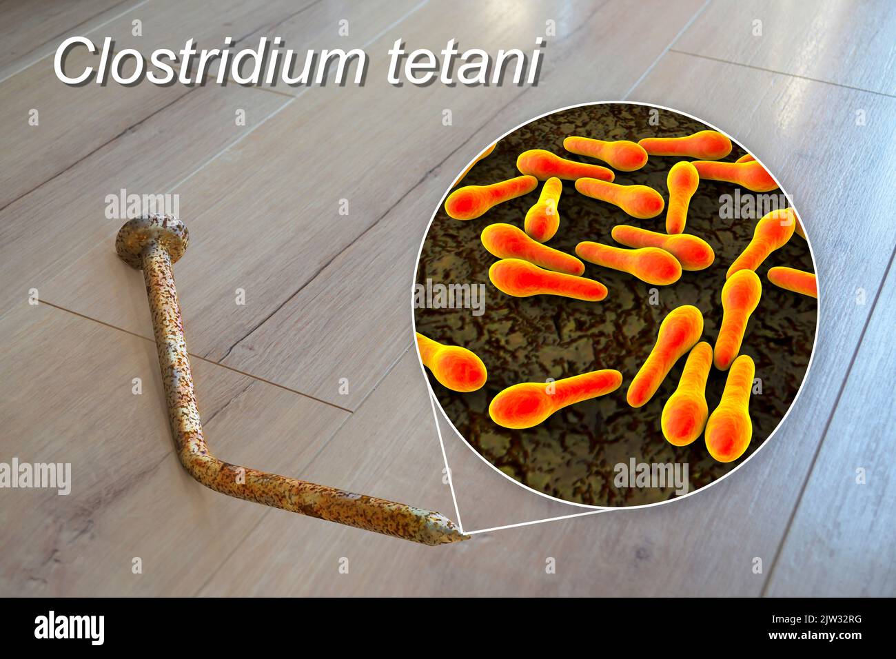 Übertragung von Tetanusbakterien. Konzeptionelle Illustration mit einem alten rostigen Metallnagel als Infektionsquelle und einer Nahaufnahme von Clostridium tetani-Bakterien, der Ursache von Tetanus. Stockfoto