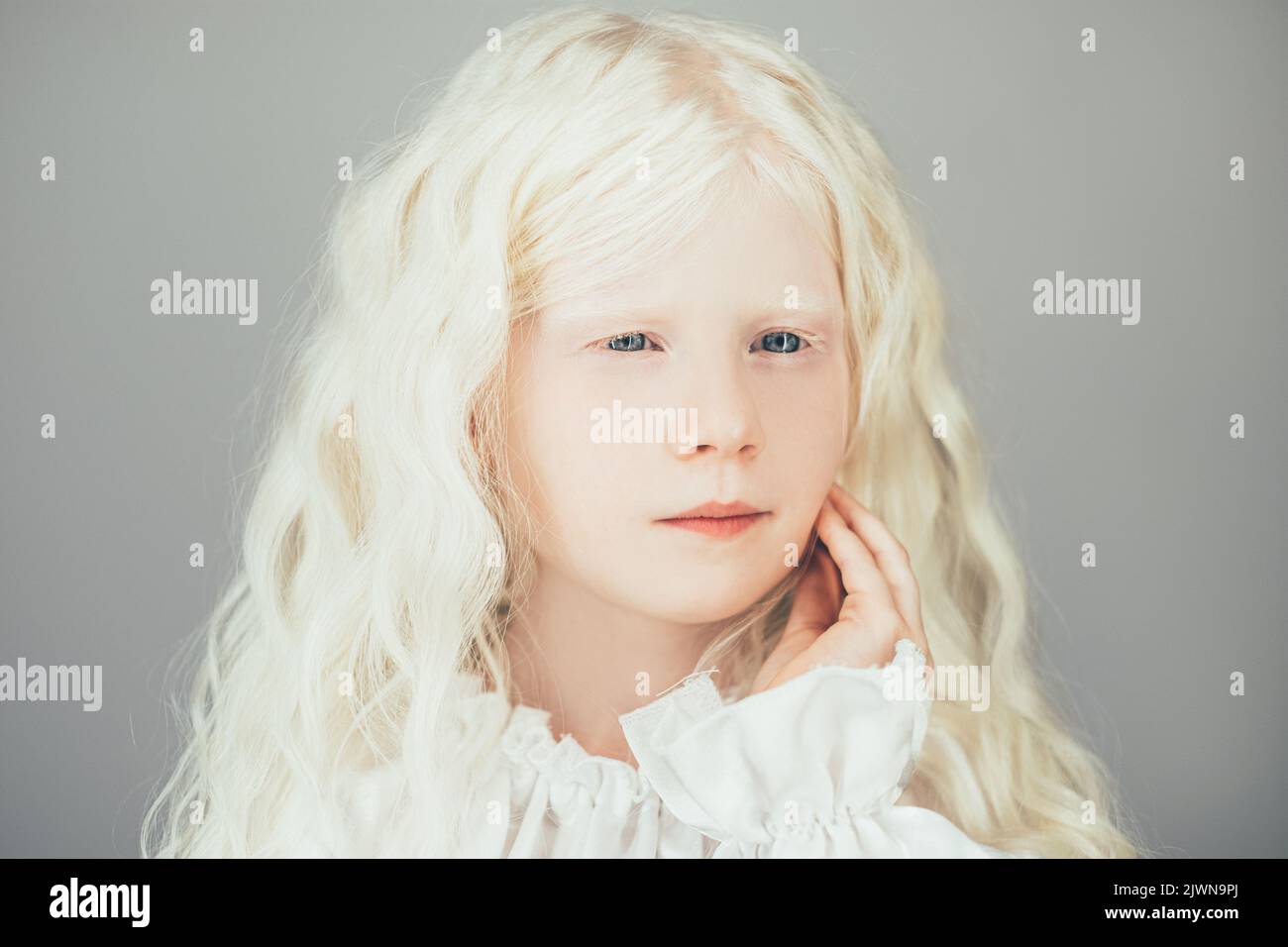 albino Schönheit süß Kind Portrait blonde Mädchen Stockfoto