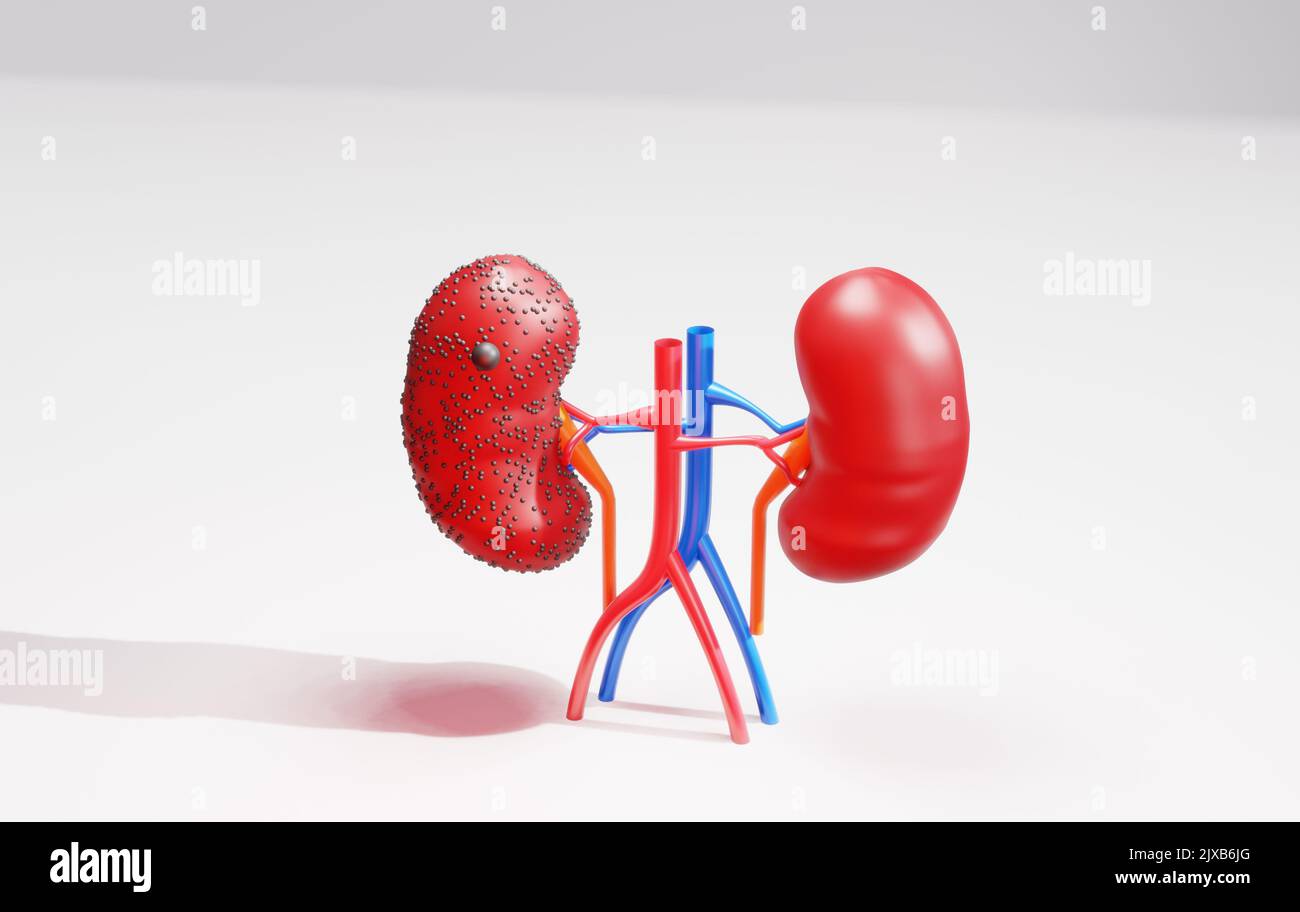 Menschliche Nieren Krankheit Anatomie außerhalb 3D Rendering Bild Konzept des Harnsystems Bild Stockfoto