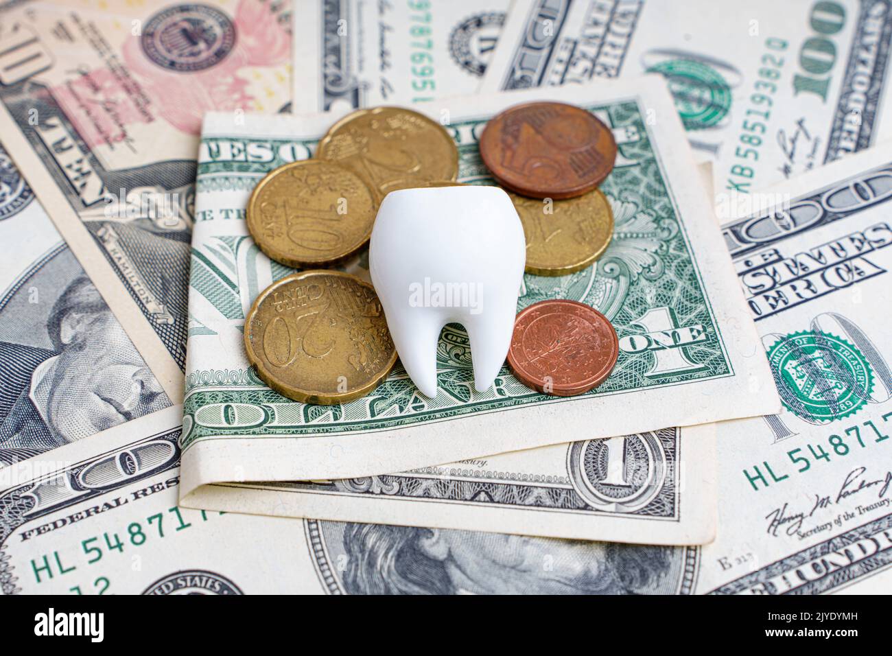 Großer weißer Zahn auf einem Stapel von Dollarscheinen und Euromünzen. Hintergrund der zahnärztlichen Pflegekosten. Stockfoto