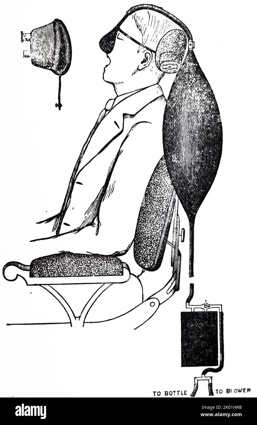 Coleman's Apparat (1898) zur Erlangung einer längeren Anästhesie durch Lachgas (Lachgas). Von Dudley Wilmot Buxton Anaesthestics Their uses and Administration, London, 1900. Stockfoto