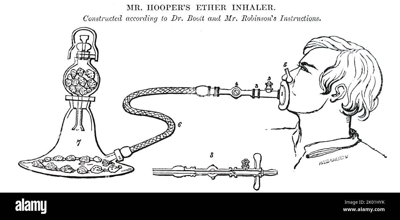 Äther-Inhalator. Vom Lancet, London, 1847. Stockfoto