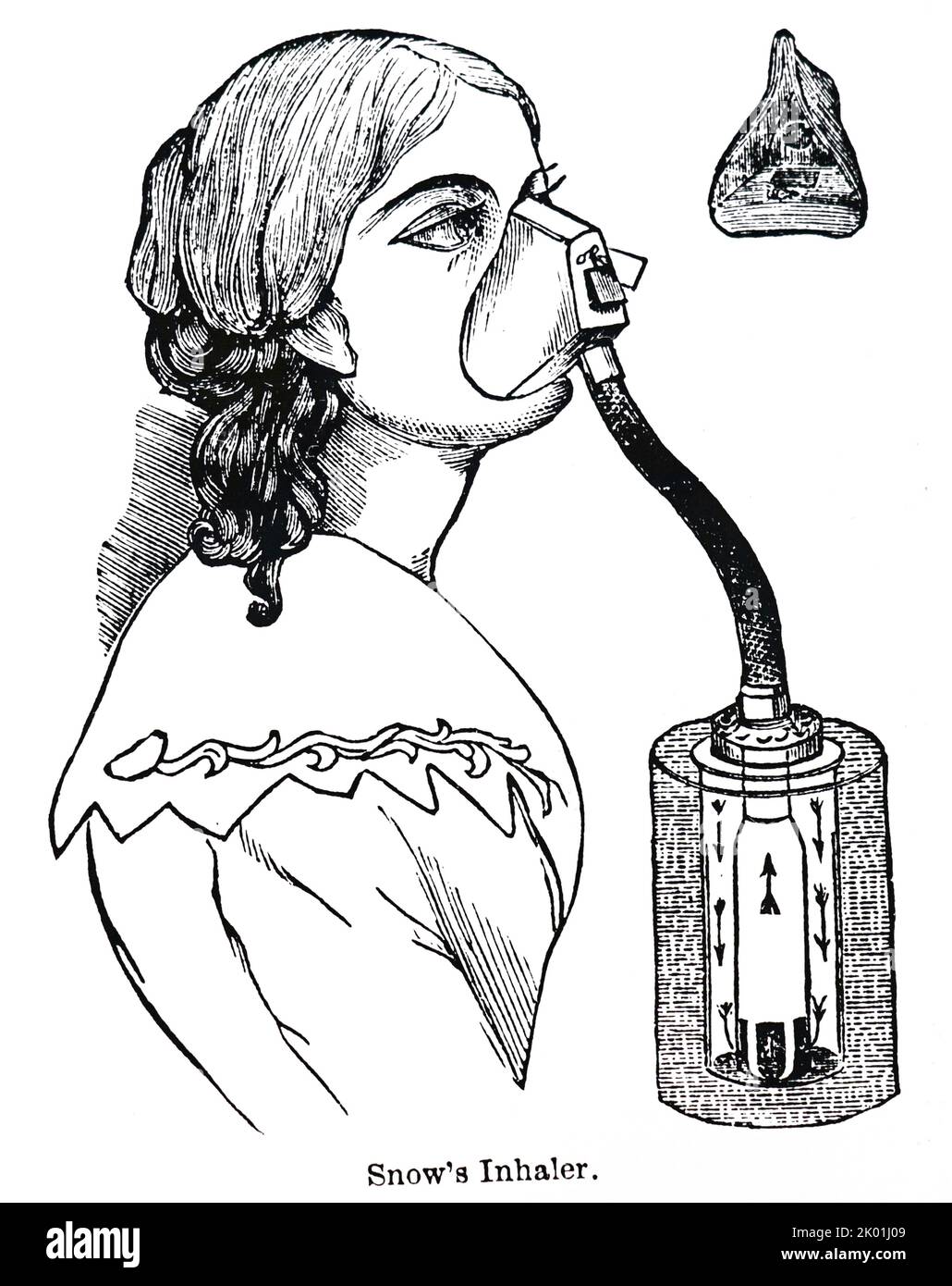 Schnee-Inhalator, der sowohl für Chloroform als auch für Äther verwendet wurde. Von Henry M Lyman Artificial Anesthesia and Anaesthestics, London, 1883. Stockfoto