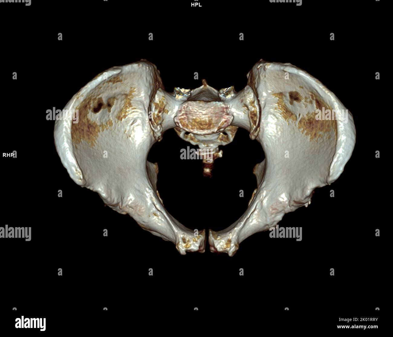 CT-Scan von Becken- und Hüftgelenk 3D zur Diagnose Fraktur von Becken- und Hüftgelenk isoliert auf weißem Hintergrund. Stockfoto