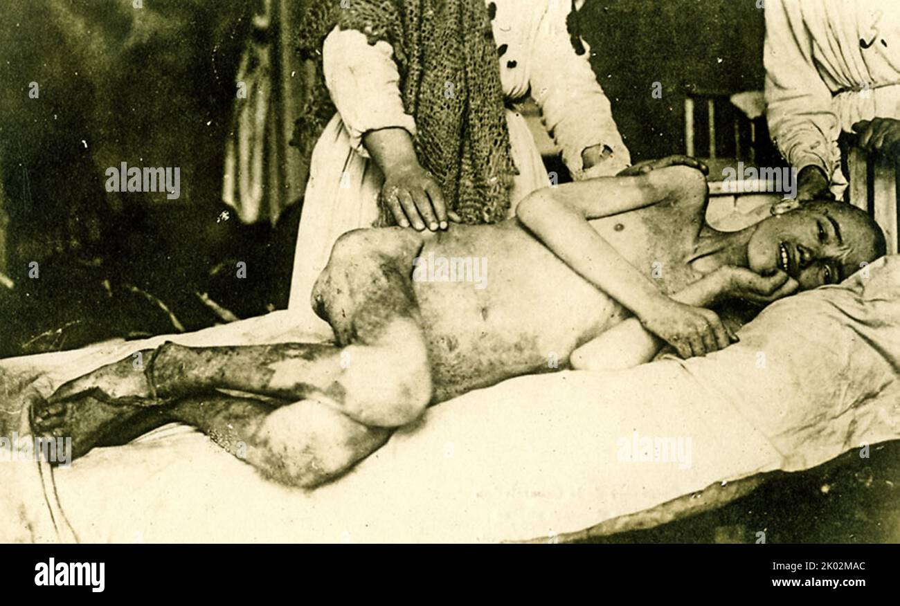 Hungernder Junge in Huliaipole, einer Stadt im Gebiet Saporischschja, Ukraine, während der sowjetischen Hungersnot 1921-23 Stockfoto