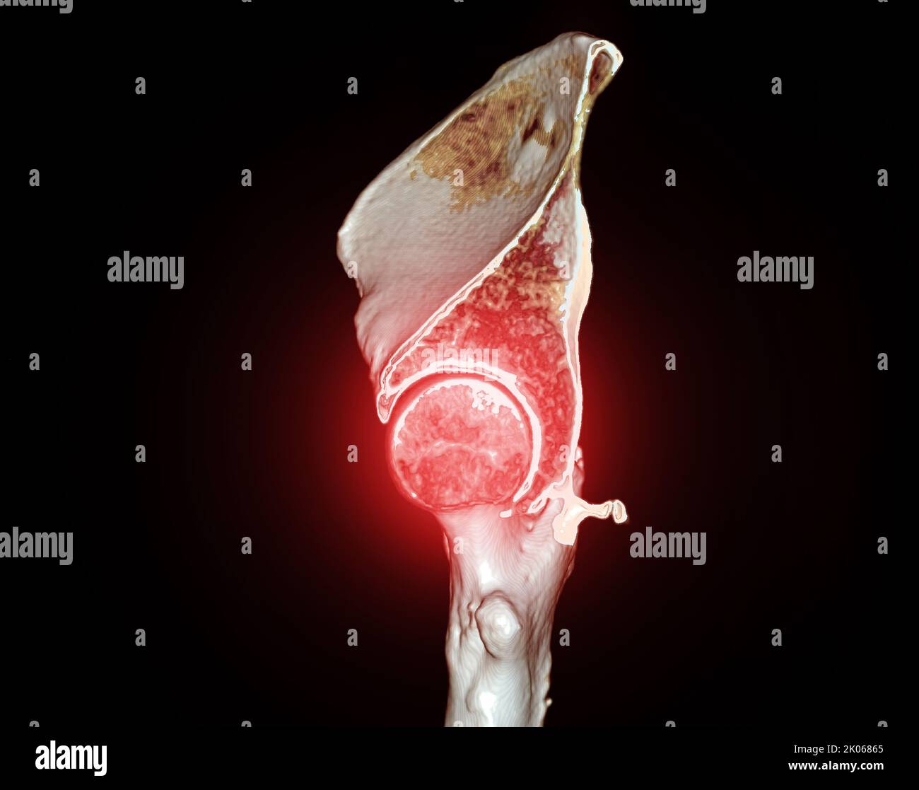 CT-Scan von Becken- und Hüftgelenk 3D zur Diagnose Fraktur von Becken- und Hüftgelenk isoliert auf schwarzem Hintergrund. Stockfoto