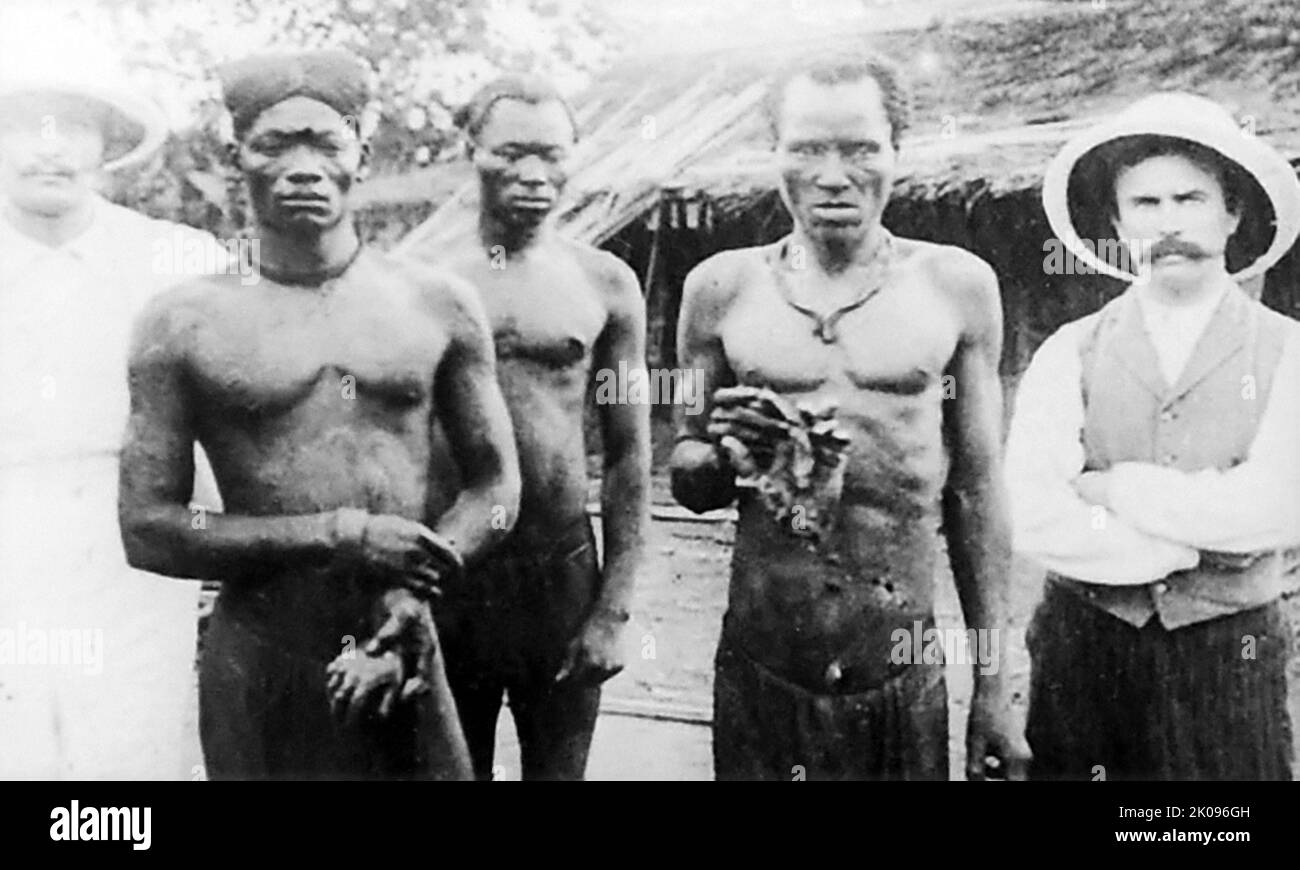 König Leopold II. Von der belgischen Verwaltung des Kongo-Freistaates war von Gräueltaten, einschließlich Folter und Mord, die auf berüchtigte systematische Brutalität zurückzuführen waren, gekennzeichnet. Die Hände von Männern, Frauen und Kindern wurden amputiert, als die Gummiquote nicht erreicht wurde und Millionen der kongolesischen Bevölkerung starben. Stockfoto