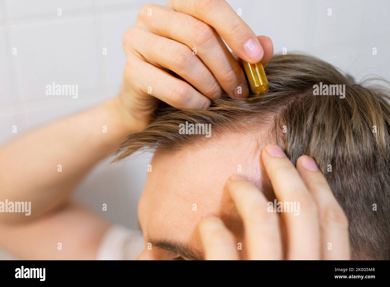 Weißer Mann mittleren Alters verwendet, gilt für Haare mit kosmetischen Ampullen mit Serum für Haarwachstum, Wiederherstellung Schönheitsbehaarung. Das Konzept Stockfoto