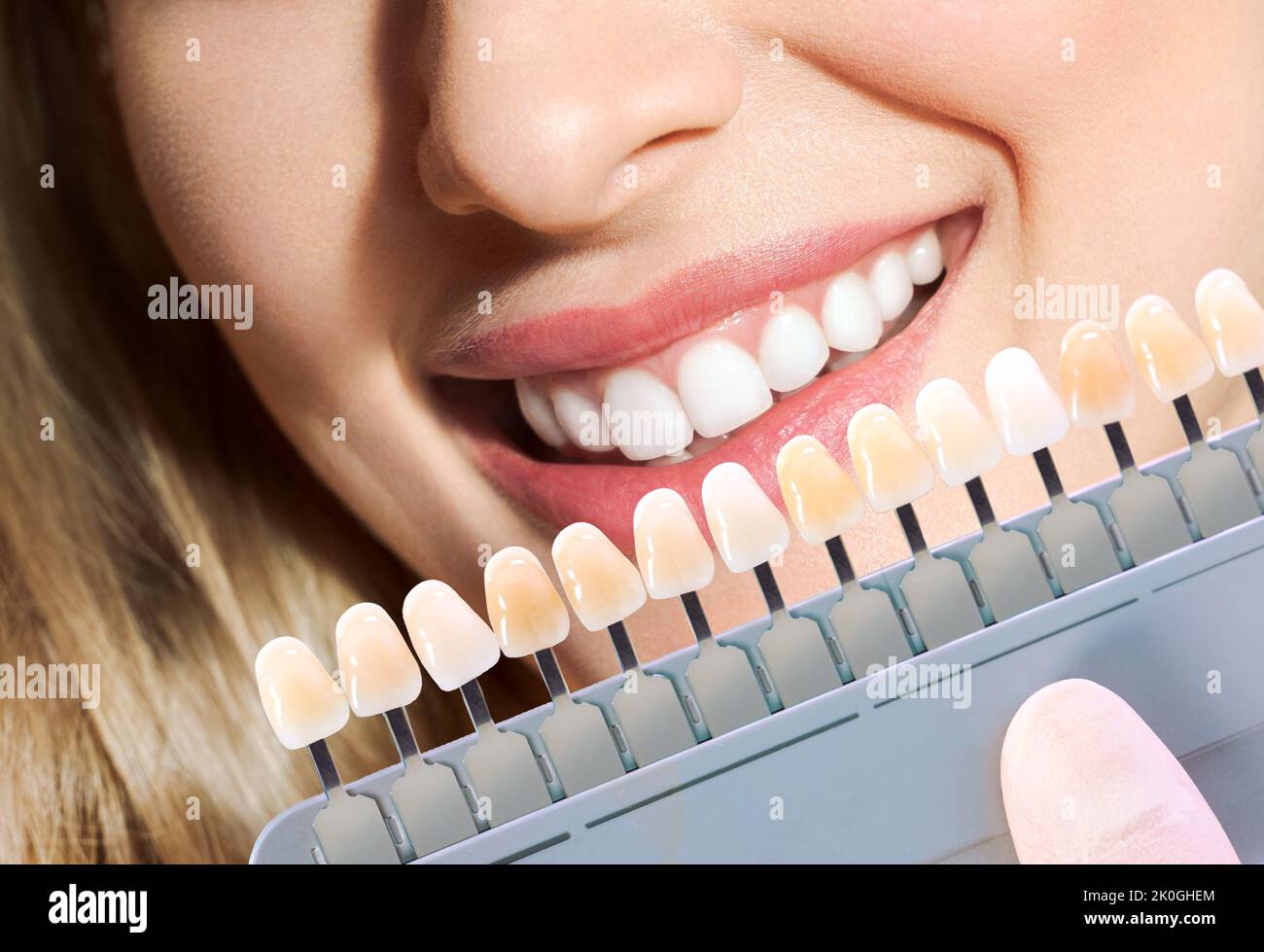 Arzt, der die Zahnfarbe des Patienten mit der Palette, Nahaufnahme, zusammenpasst. Kosmetische Zahnheilkunde Stockfoto