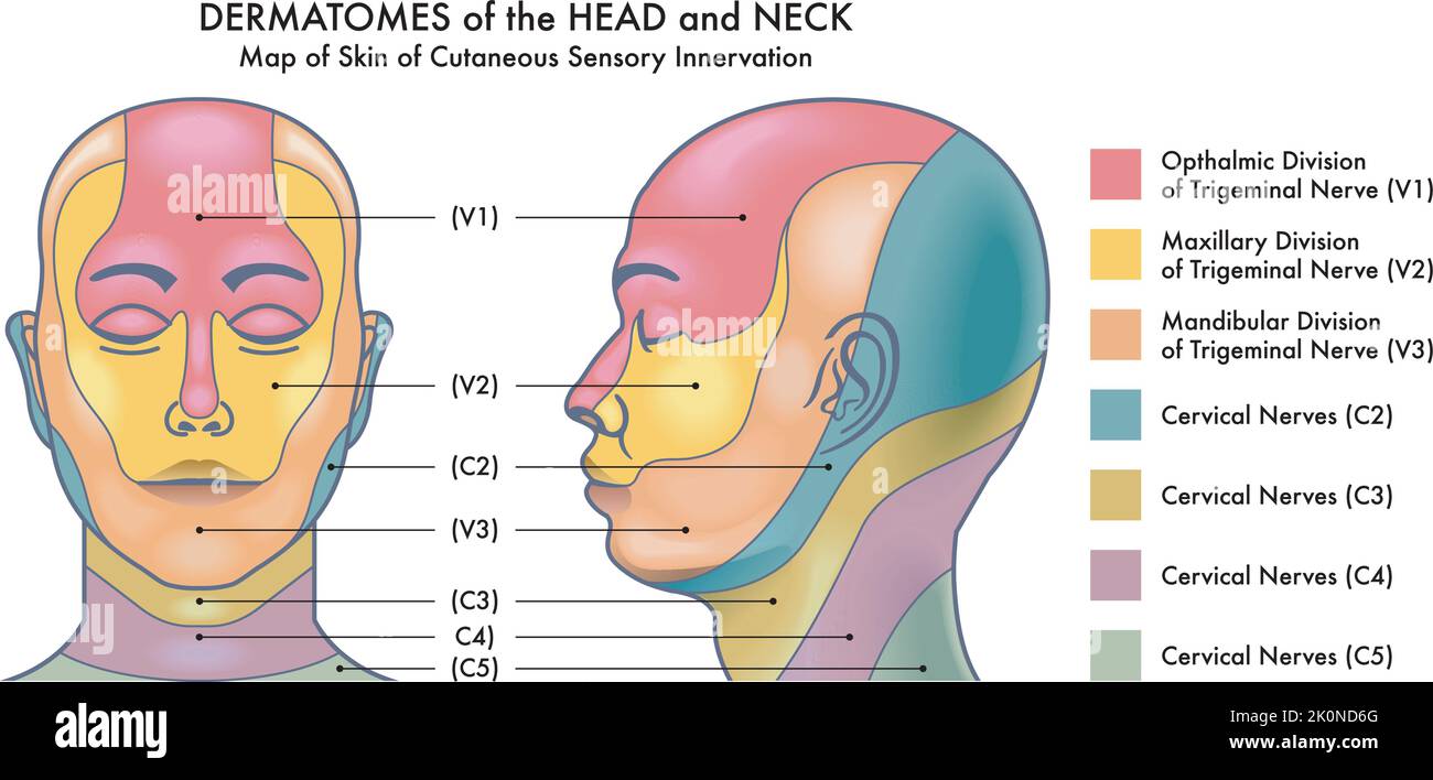 Medizinisches Diagramm von Dermatomen des Kopfes und Halses. Stock Vektor