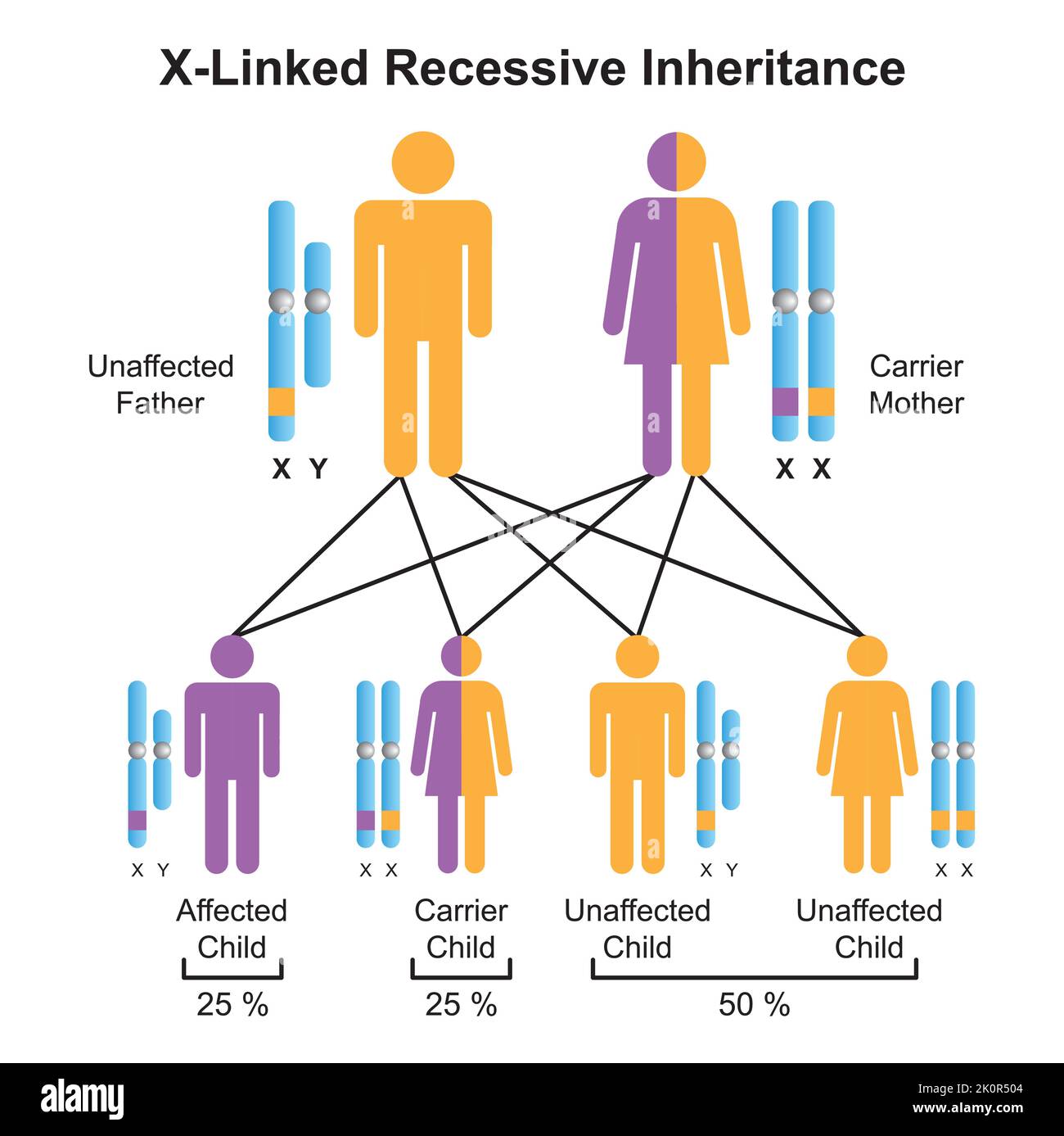 Wissenschaftliche Gestaltung der X-verknüpften rezessiven Vererbung. Bunte Symbole. Vektorgrafik. Stock Vektor