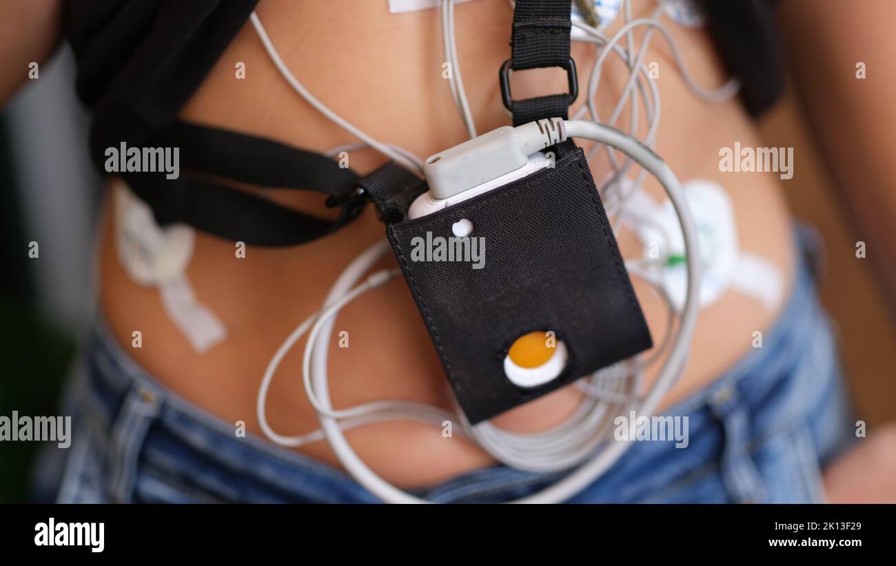 Der EKG-holter-Monitor hängt in Nahaufnahme am Körper des Patienten Stockfoto