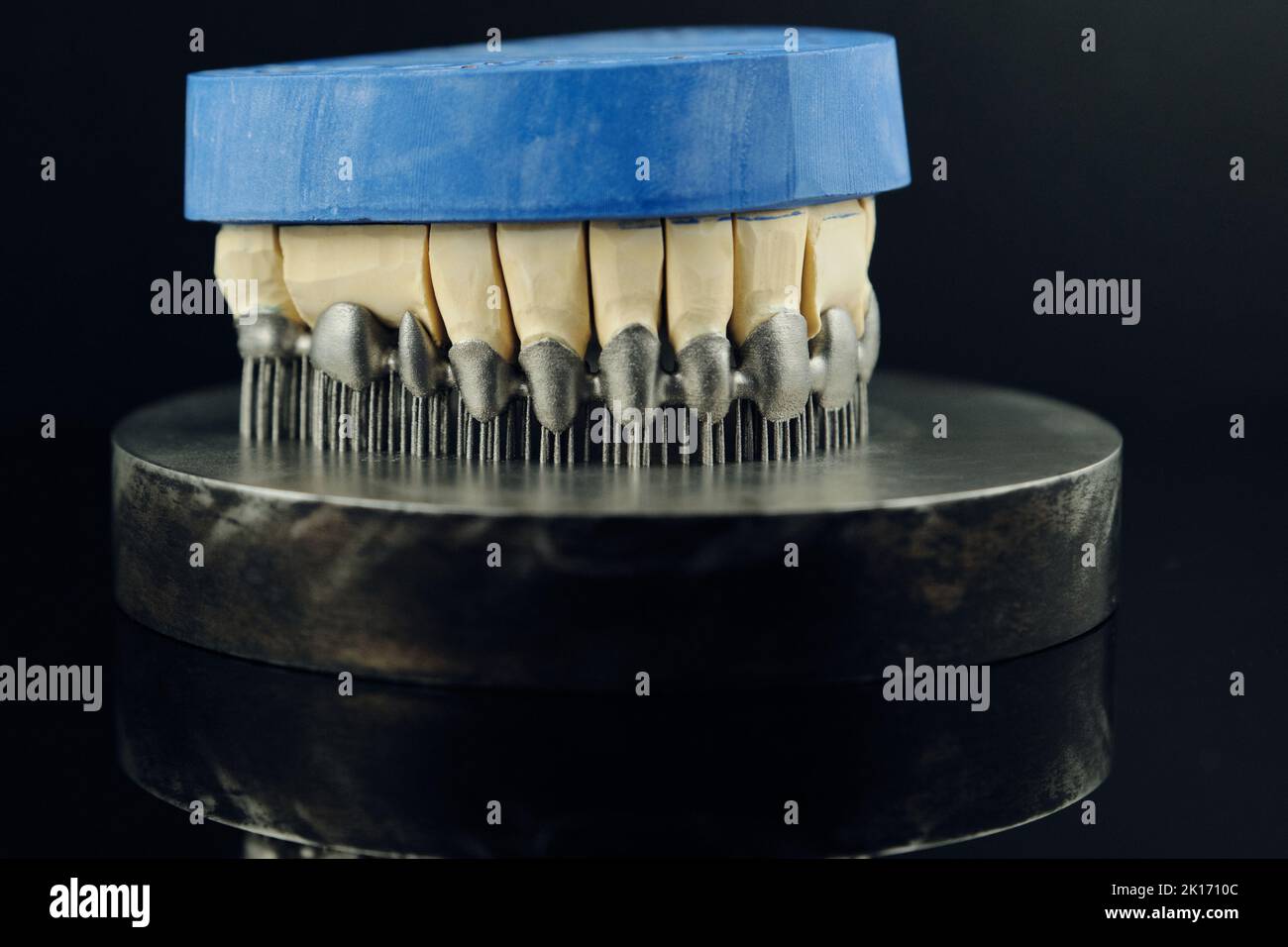Zahnkronen auf 3D Drucker für Metall erstellt. Gipsmodell auf einem bedruckten Metallrahmen Stockfoto