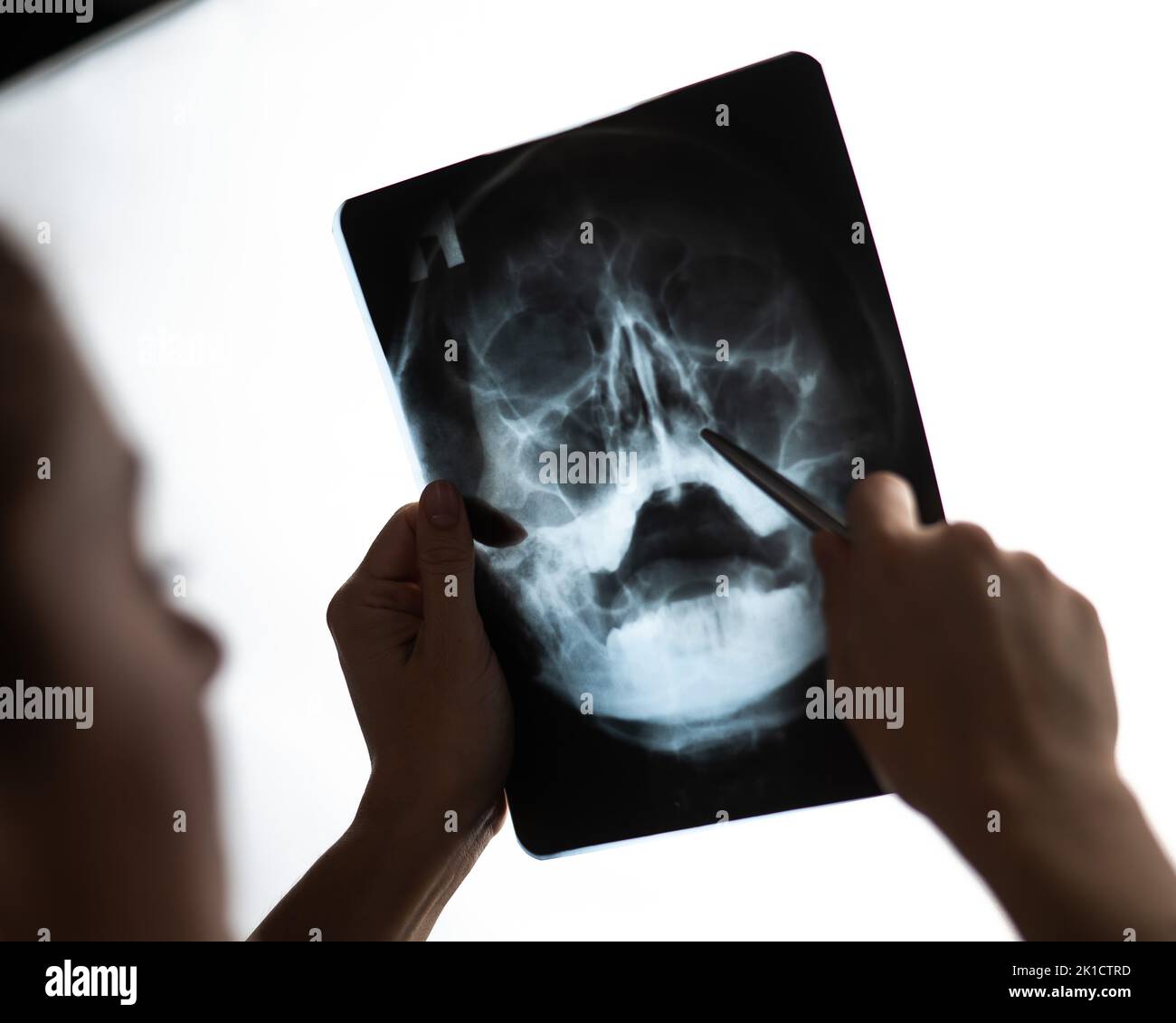 Der Arzt betrachtet die Röntgenaufnahme der Nebenhöhlen. Stockfoto