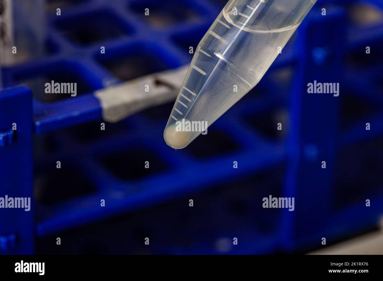 Reagenzglas mit Blutkörperchen, das nach mehreren Wäschen und Zentrifugation gewonnen wurde. Stockfoto
