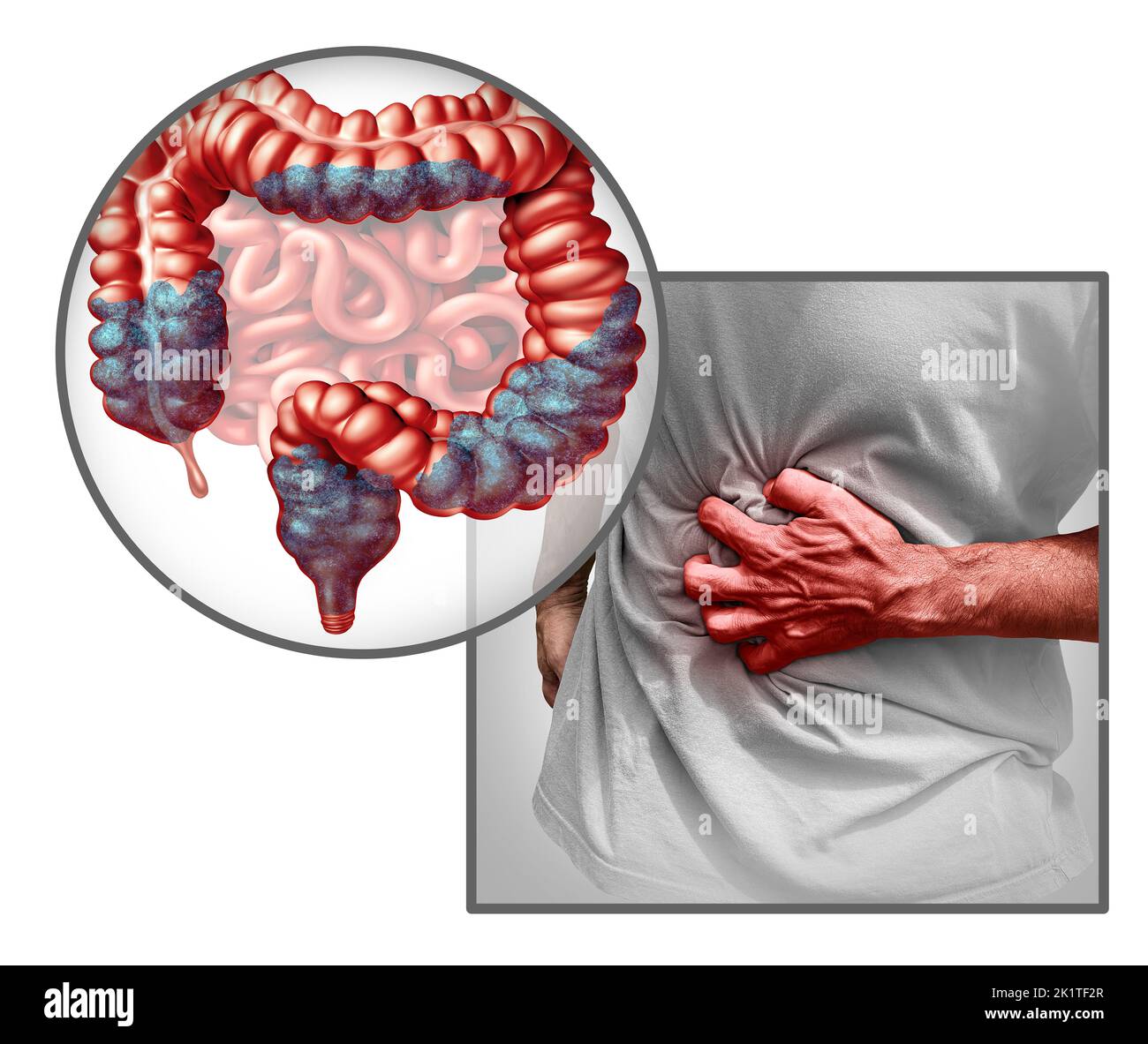 Verstopfung Anatomie und Verstopfung Symptome als Stuhl Stuhlgang Problem als Darm und Rektum eines Verdauungssystems auf weiß. Stockfoto