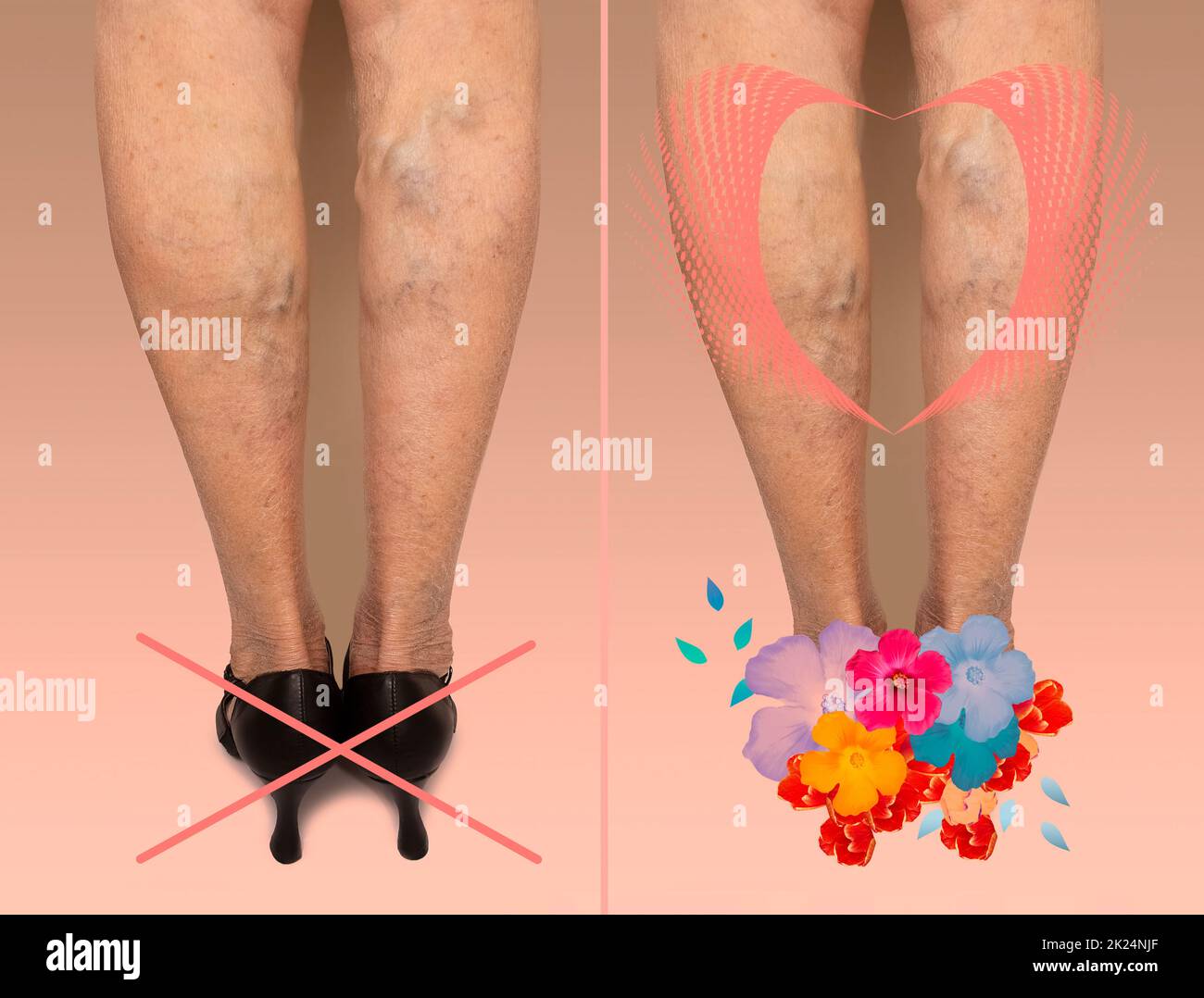 Schmerzhafte Krampfadern und Besenreiser an den weiblichen Beinen. Ältere Frau in Fersen und müden Beinen. Konzept der Komfortschuhe Stockfoto