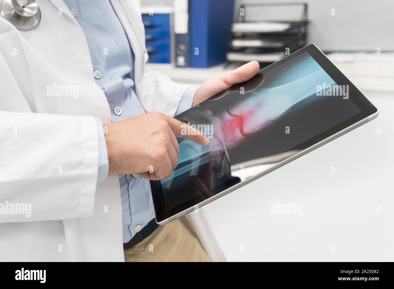 Der Arzt untersucht ein Röntgenbild eines Patienten in einer digitalen Tablette in der Arztpraxis. Hochwertige Fotografie. Stockfoto