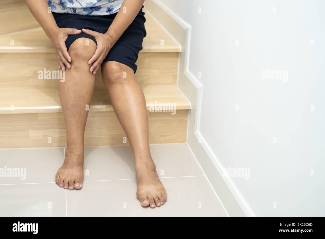 Asiatische Frau mittleren Alters Frau Patientin fallen die Treppe hinunter und Schmerzen ihr Knie, weil rutschige Oberflächen mit Kopieplatz. Stockfoto