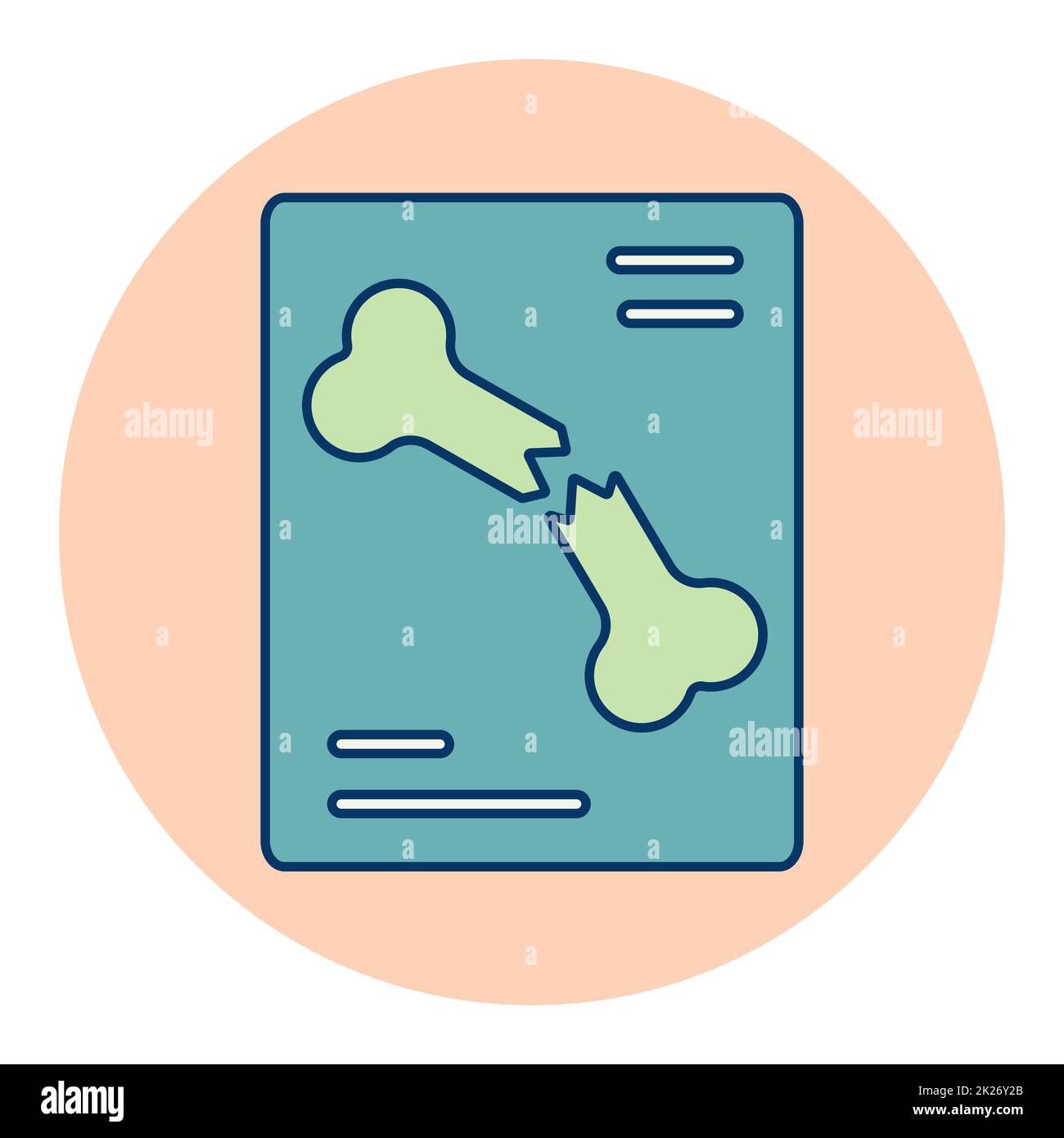 Röntgenvektorsymbol für Knochenfraktur Stockfoto